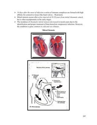  14 days after the onset of infection a series of immune complexes are formed with high
affinity for connective tissue (like heart valves – M protein).
 Mitral stenosis occurs after a free interval of 10-20 years from initial rheumatic attack,
but is often asymptomatic in the early stages.
 The incidence of rheumatic mitral stenosis decreased in recent years due to the
identification and proper treatment of beta-hemolytic streptococci infection. However,
the condition is quite common in cold and wet climates.
Mitral Stenosis
247
 