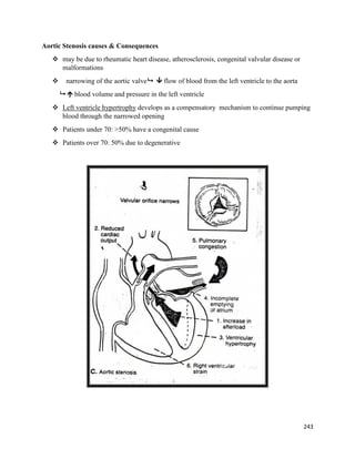 Aortic Stenosis causes & Consequences
 may be due to rheumatic heart disease, atherosclerosis, congenital valvular disease or
malformations
 narrowing of the aortic valve  flow of blood from the left ventricle to the aorta
  blood volume and pressure in the left ventricle
 Left ventricle hypertrophy develops as a compensatory mechanism to continue pumping
blood through the narrowed opening
 Patients under 70: >50% have a congenital cause
 Patients over 70: 50% due to degenerative
243
 