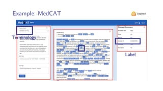 Example: MedCAT
Terminology
Label
 