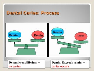 lecture 11 & 12, Epidemiology of dental caries.ppt