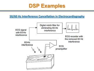 DSP Examples
50/60 Hz Interference Cancellation in Electrocardiography
15
 
