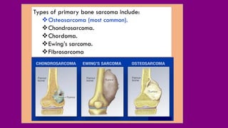 Types of primary bone sarcoma include:
Osteosarcoma (most common).
Chondrosarcoma.
Chordoma.
Ewing’s sarcoma.
Fibrosarcoma
 