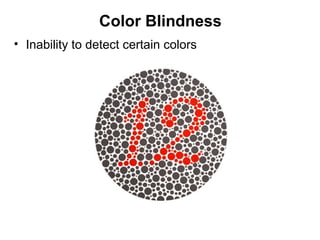 Color Blindness
• Inability to detect certain colors

Figure 17–17

 