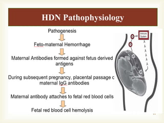 Hemolytic Disease of newborn .. In which Hemolysis if RBC Occurs | PPTX