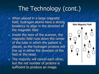 The Technology (cont.)
n  When placed in a large magnetic
field, hydrogen atoms have a strong
tendency to align in the direction of
the magnetic filed
n  Inside the bore of the scanner, the
magnetic field runs down the center
of the tube in which the patient is
placed, so the hydrogen protons will
line up in either the direction of the
feet or the head.
n  The majority will cancel each other,
but the net number of protons is
sufficient to produce an image.
 