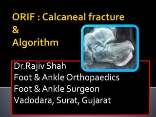 Dr.Rajiv Shah
Foot & Ankle Orthopaedics
Foot & Ankle Surgeon
Vadodara, Surat, Gujarat
 