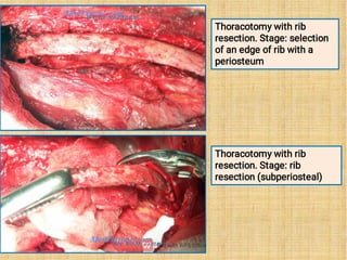 Lecture 12 Topographic anatomy of the chest.pdf