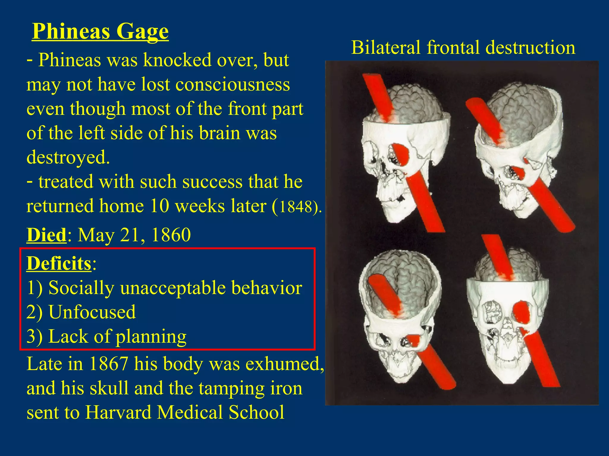 Died: May 21, 1860
Late in 1867 his body was exhumed,
and his skull and the tamping iron
sent to Harvard Medical School
Phineas Gage
Bilateral frontal destruction
Deficits:
1) Socially unacceptable behavior
2) Unfocused
3) Lack of planning
- Phineas was knocked over, but
may not have lost consciousness
even though most of the front part
of the left side of his brain was
destroyed.
- treated with such success that he
returned home 10 weeks later (1848).
 