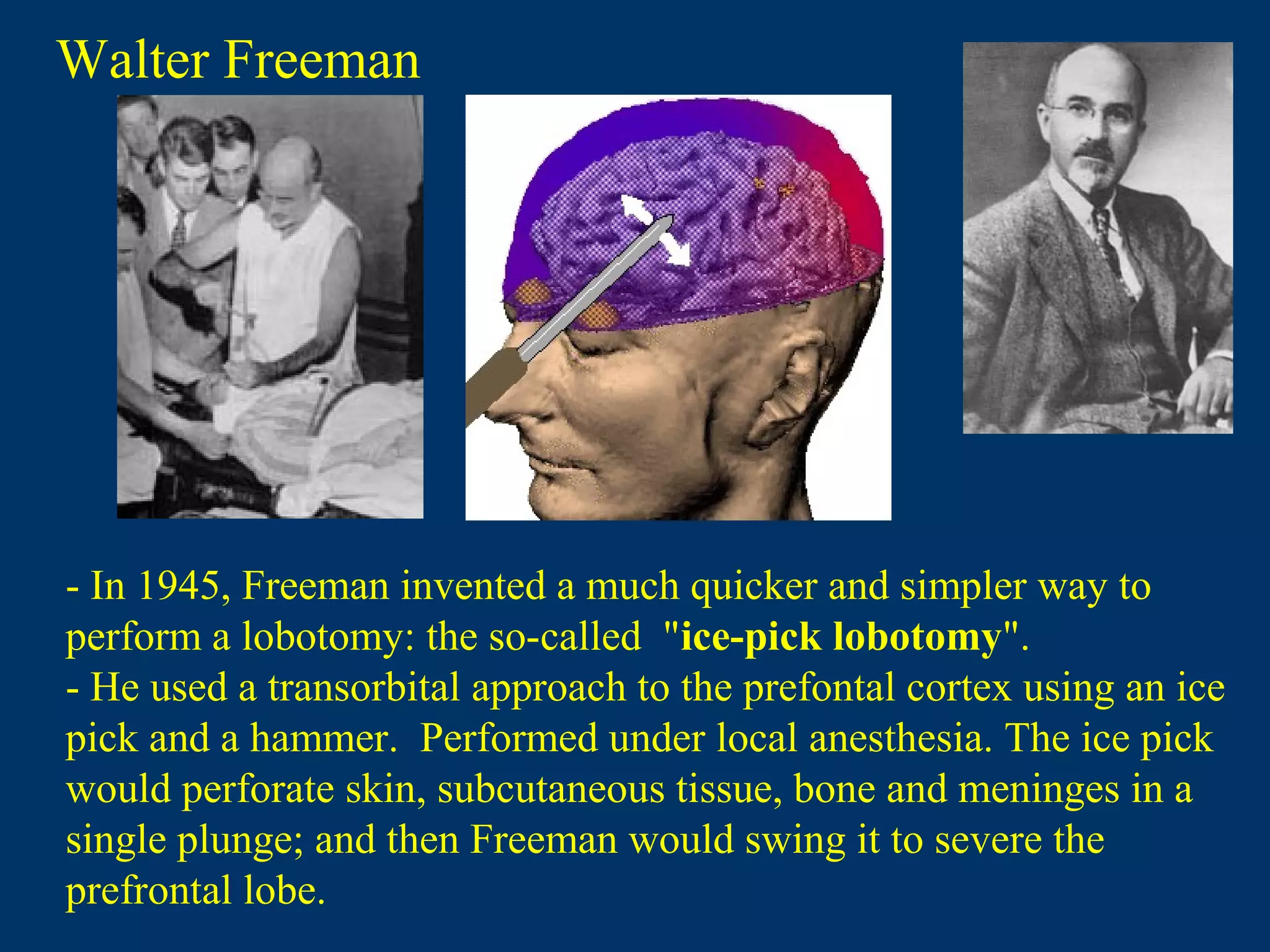 Walter Freeman
- In 1945, Freeman invented a much quicker and simpler way to
perform a lobotomy: the so-called "ice-pick lobotomy".
- He used a transorbital approach to the prefontal cortex using an ice
pick and a hammer. Performed under local anesthesia. The ice pick
would perforate skin, subcutaneous tissue, bone and meninges in a
single plunge; and then Freeman would swing it to severe the
prefrontal lobe.
 