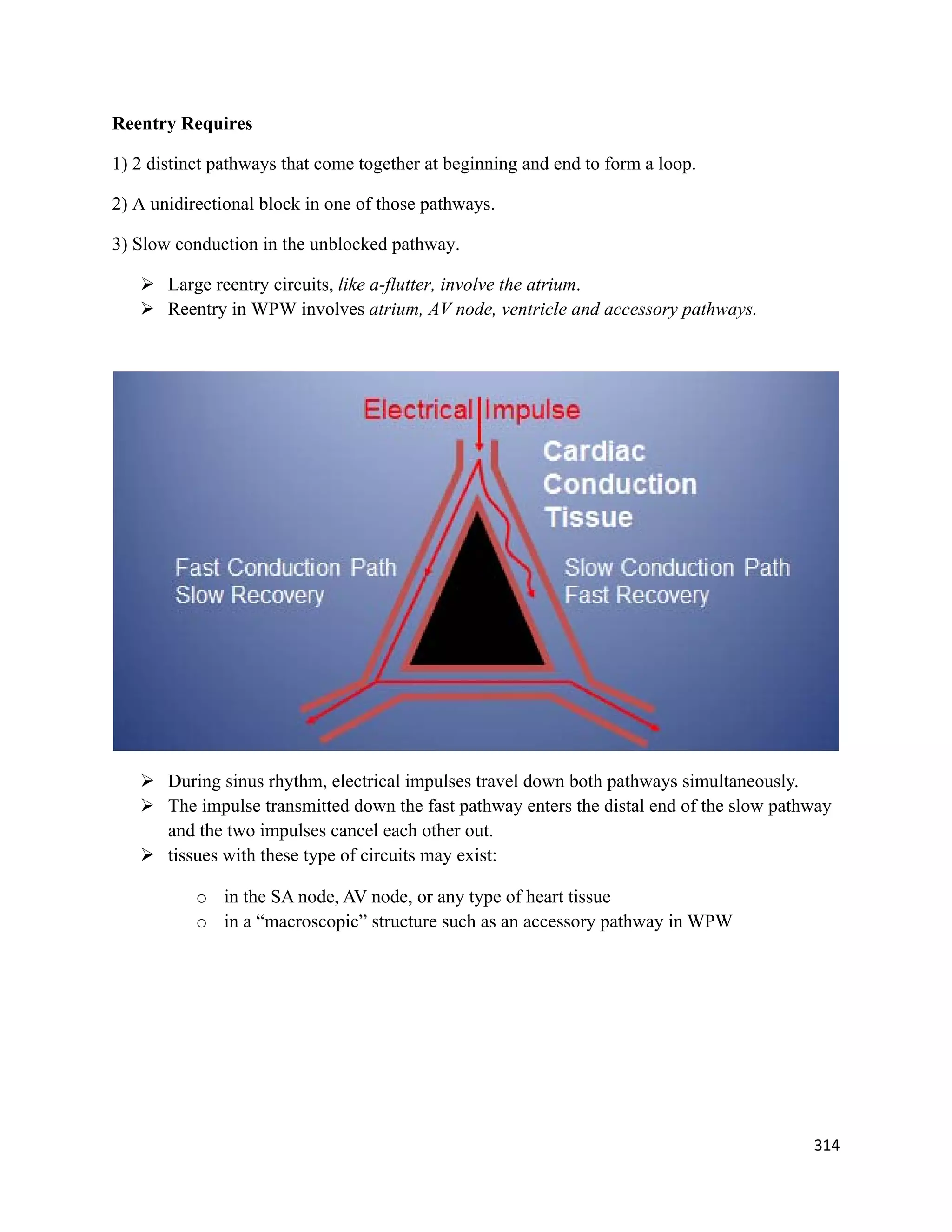314 
 
Reentry Requires
1) 2 distinct pathways that come together at beginning and end to form a loop.
2) A unidirectional block in one of those pathways.
3) Slow conduction in the unblocked pathway.
 Large reentry circuits, like a-flutter, involve the atrium.
 Reentry in WPW involves atrium, AV node, ventricle and accessory pathways.
 During sinus rhythm, electrical impulses travel down both pathways simultaneously.
 The impulse transmitted down the fast pathway enters the distal end of the slow pathway
and the two impulses cancel each other out.
 tissues with these type of circuits may exist:
o in the SA node, AV node, or any type of heart tissue
o in a “macroscopic” structure such as an accessory pathway in WPW
 