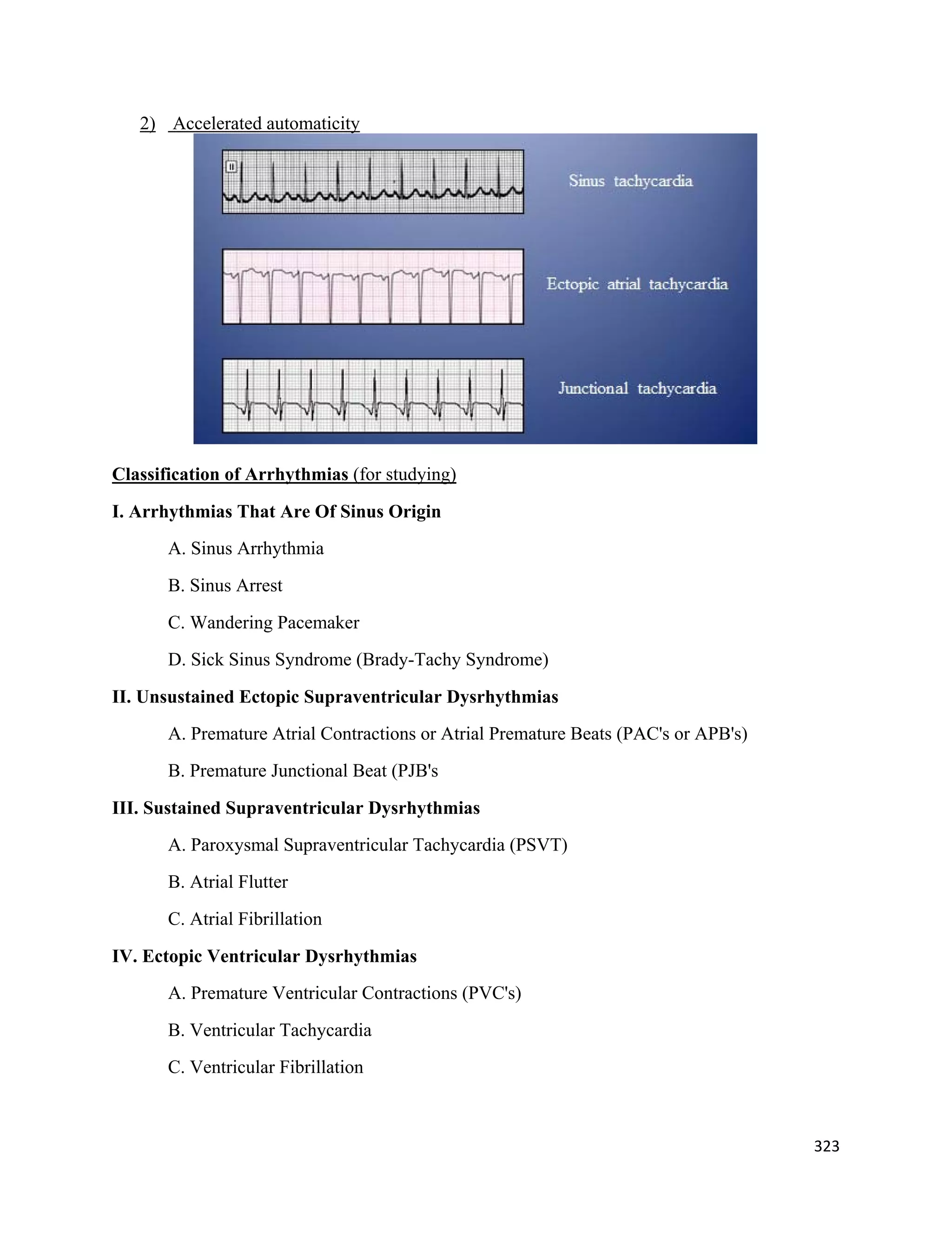 323 
 
2) Accelerated automaticity
Classification of Arrhythmias (for studying)
I. Arrhythmias That Are Of Sinus Origin
A. Sinus Arrhythmia
B. Sinus Arrest
C. Wandering Pacemaker
D. Sick Sinus Syndrome (Brady-Tachy Syndrome)
II. Unsustained Ectopic Supraventricular Dysrhythmias
A. Premature Atrial Contractions or Atrial Premature Beats (PAC's or APB's)
B. Premature Junctional Beat (PJB's
III. Sustained Supraventricular Dysrhythmias
A. Paroxysmal Supraventricular Tachycardia (PSVT)
B. Atrial Flutter
C. Atrial Fibrillation
IV. Ectopic Ventricular Dysrhythmias
A. Premature Ventricular Contractions (PVC's)
B. Ventricular Tachycardia
C. Ventricular Fibrillation
 