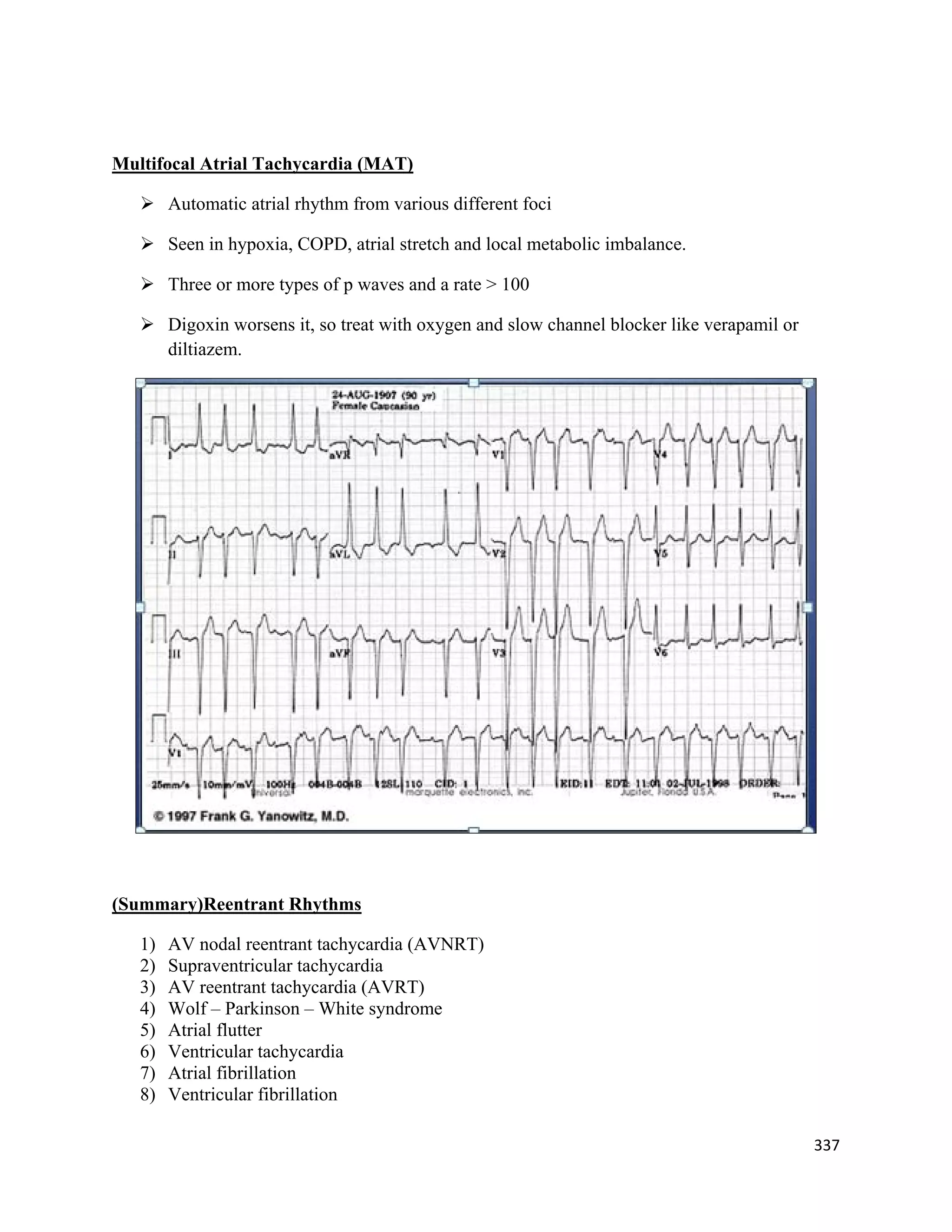 337 
 
Multifocal Atrial Tachycardia (MAT)
 Automatic atrial rhythm from various different foci
 Seen in hypoxia, COPD, atrial stretch and local metabolic imbalance.
 Three or more types of p waves and a rate > 100
 Digoxin worsens it, so treat with oxygen and slow channel blocker like verapamil or
diltiazem.
(Summary)Reentrant Rhythms
1) AV nodal reentrant tachycardia (AVNRT)
2) Supraventricular tachycardia
3) AV reentrant tachycardia (AVRT)
4) Wolf – Parkinson – White syndrome
5) Atrial flutter
6) Ventricular tachycardia
7) Atrial fibrillation
8) Ventricular fibrillation
 