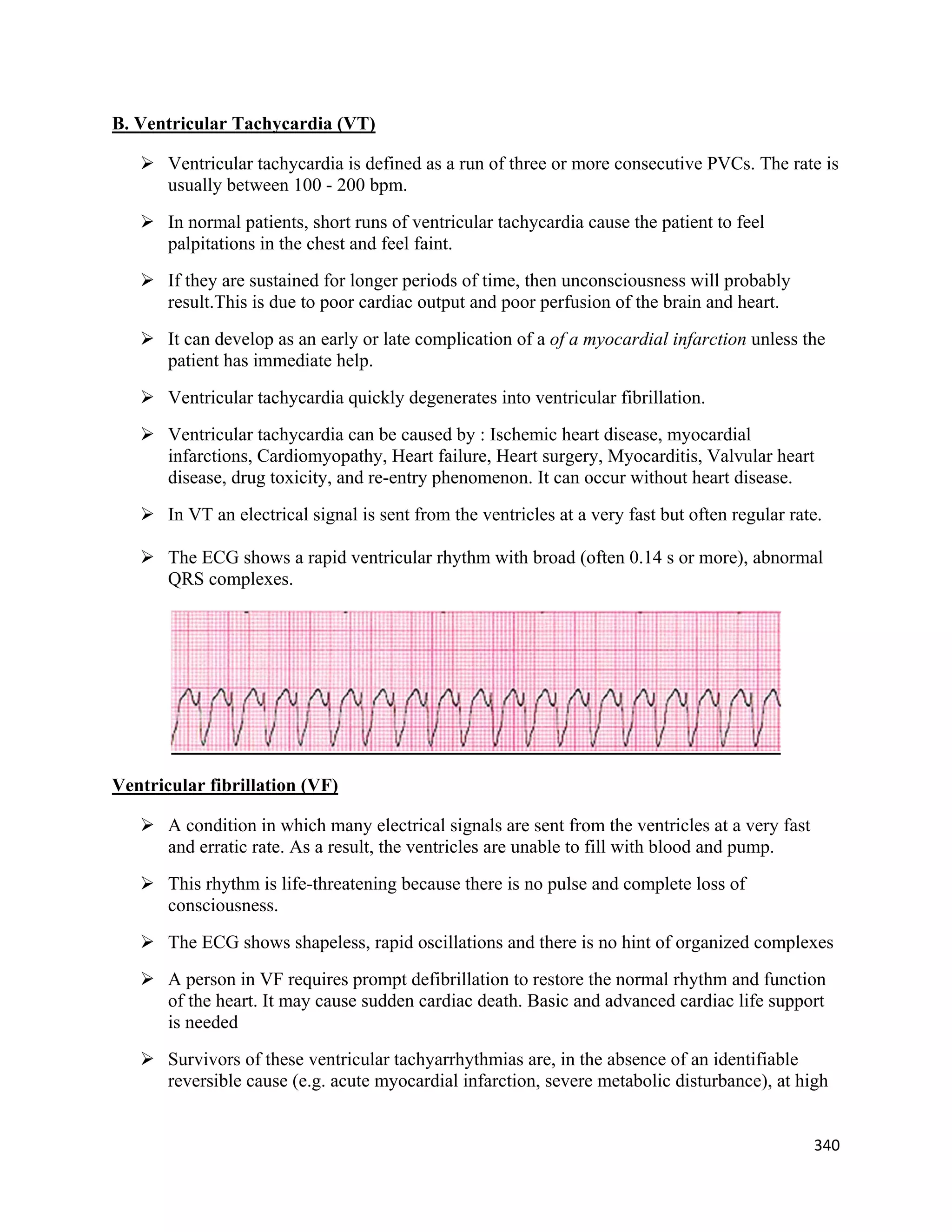 340 
 
B. Ventricular Tachycardia (VT)
 Ventricular tachycardia is defined as a run of three or more consecutive PVCs. The rate is
usually between 100 - 200 bpm.
 In normal patients, short runs of ventricular tachycardia cause the patient to feel
palpitations in the chest and feel faint.
 If they are sustained for longer periods of time, then unconsciousness will probably
result.This is due to poor cardiac output and poor perfusion of the brain and heart.
 It can develop as an early or late complication of a of a myocardial infarction unless the
patient has immediate help.
 Ventricular tachycardia quickly degenerates into ventricular fibrillation.
 Ventricular tachycardia can be caused by : Ischemic heart disease, myocardial
infarctions, Cardiomyopathy, Heart failure, Heart surgery, Myocarditis, Valvular heart
disease, drug toxicity, and re-entry phenomenon. It can occur without heart disease.
 In VT an electrical signal is sent from the ventricles at a very fast but often regular rate.
 The ECG shows a rapid ventricular rhythm with broad (often 0.14 s or more), abnormal
QRS complexes.
Ventricular fibrillation (VF)
 A condition in which many electrical signals are sent from the ventricles at a very fast
and erratic rate. As a result, the ventricles are unable to fill with blood and pump.
 This rhythm is life-threatening because there is no pulse and complete loss of
consciousness.
 The ECG shows shapeless, rapid oscillations and there is no hint of organized complexes
 A person in VF requires prompt defibrillation to restore the normal rhythm and function
of the heart. It may cause sudden cardiac death. Basic and advanced cardiac life support
is needed
 Survivors of these ventricular tachyarrhythmias are, in the absence of an identifiable
reversible cause (e.g. acute myocardial infarction, severe metabolic disturbance), at high
 