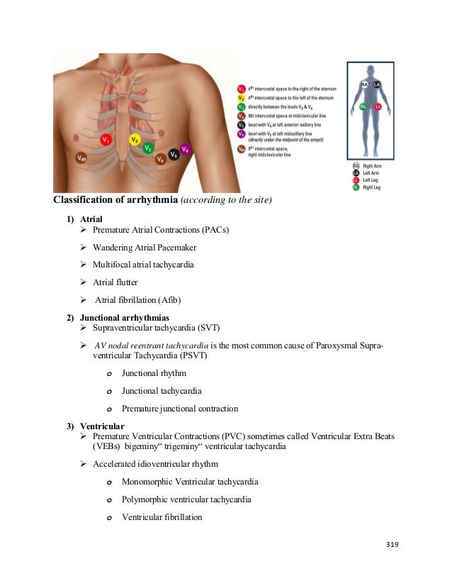 1 according to the conduction