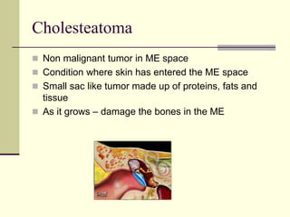 Cholesteatoma
 Non malignant tumor in ME space
 Condition where skin has entered the ME space
 Small sac like tumor made up of proteins, fats and
tissue
 As it grows – damage the bones in the ME
 