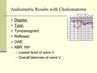 Audiometric Results with Cholesteatoma
 Degree:
 Type:
 Tympanogram:
 Reflexes:
 OAE:
 ABR: IWI
 Lowest level of wave V
 Overall latencies of wave V
 