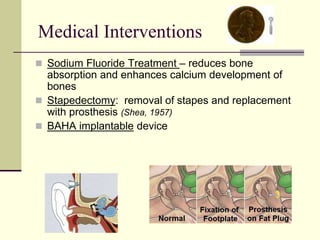 Medical Interventions
 Sodium Fluoride Treatment – reduces bone
absorption and enhances calcium development of
bones
 Stapedectomy: removal of stapes and replacement
with prosthesis (Shea, 1957)
 BAHA implantable device
 