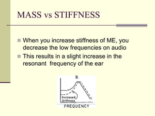 MASS vs STIFFNESS
 When you increase stiffness of ME, you
decrease the low frequencies on audio
 This results in a slight increase in the
resonant frequency of the ear
 