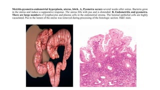 Pathology of Female Reproductive System | PDF