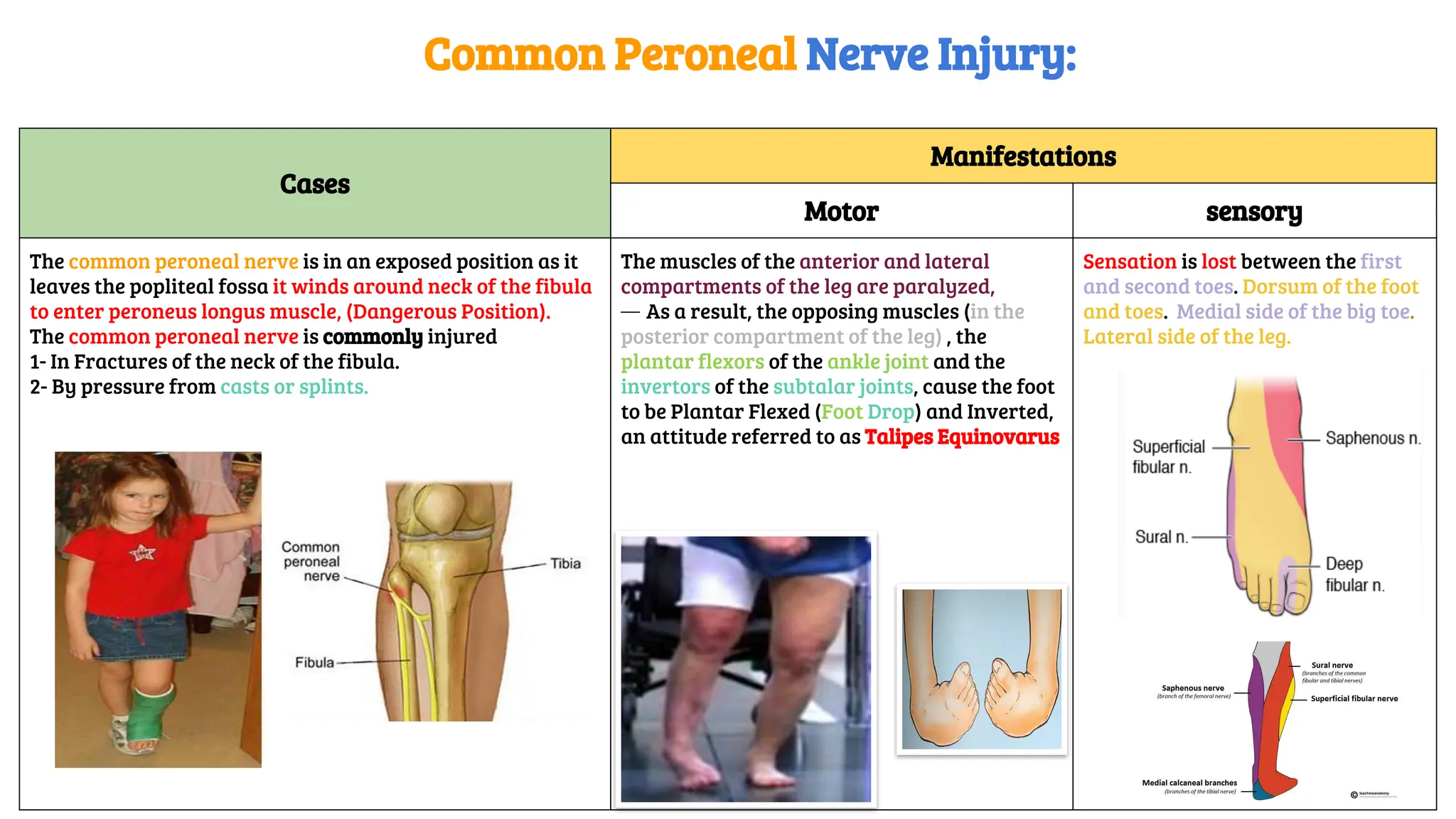 Cases
Manifestations
Motor sensory
The common peroneal nerve is in an exposed position as it
leaves the popliteal fossa it winds around neck of the fibula
to enter peroneus longus muscle, (Dangerous Position).
The common peroneal nerve is commonly injured
1- In Fractures of the neck of the fibula.
2- By pressure from casts or splints.
The muscles of the anterior and lateral
compartments of the leg are paralyzed,
— As a result, the opposing muscles (in the
posterior compartment of the leg) , the
plantar flexors of the ankle joint and the
invertors of the subtalar joints, cause the foot
to be Plantar Flexed (Foot Drop) and Inverted,
an attitude referred to as Talipes Equinovarus
Sensation is lost between the first
and second toes. Dorsum of the foot
and toes. Medial side of the big toe.
Lateral side of the leg.
Common Peroneal Nerve Injury:
 