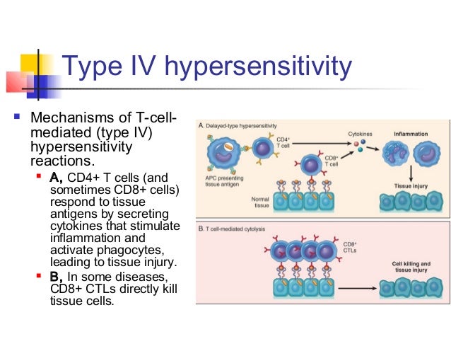 hypersensitivity reaction