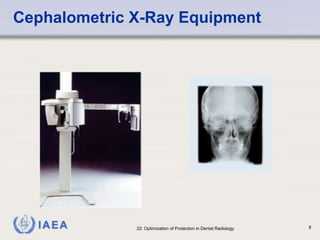 Optimisation Radiography Lecture 14 Optimization Dental radiology.ppt
