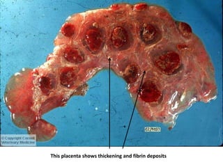 This placenta shows thickening and fibrin deposits
 