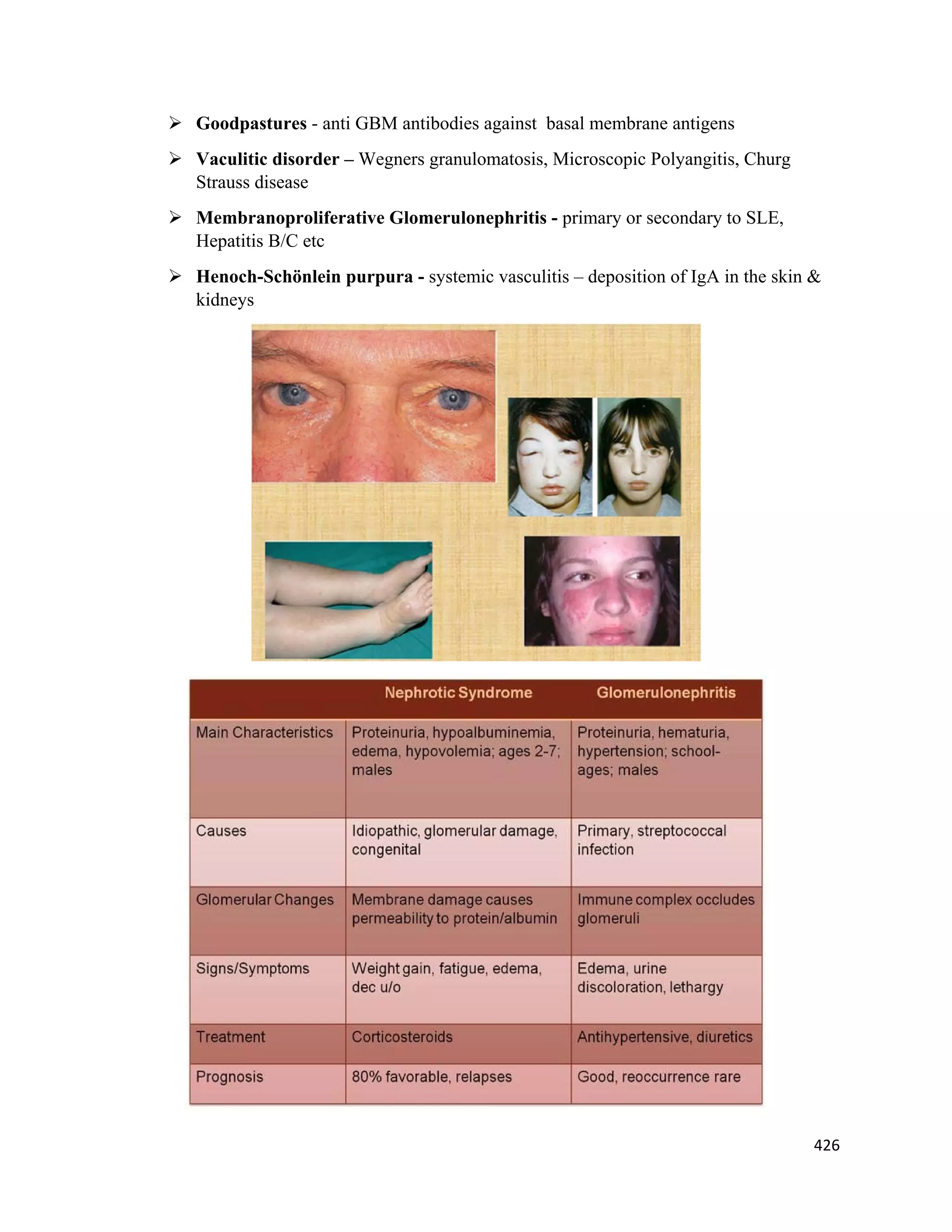 426 
 
 Goodpastures - anti GBM antibodies against basal membrane antigens
 Vaculitic disorder – Wegners granulomatosis, Microscopic Polyangitis, Churg
Strauss disease
 Membranoproliferative Glomerulonephritis - primary or secondary to SLE,
Hepatitis B/C etc
 Henoch-Schönlein purpura - systemic vasculitis – deposition of IgA in the skin &
kidneys
 