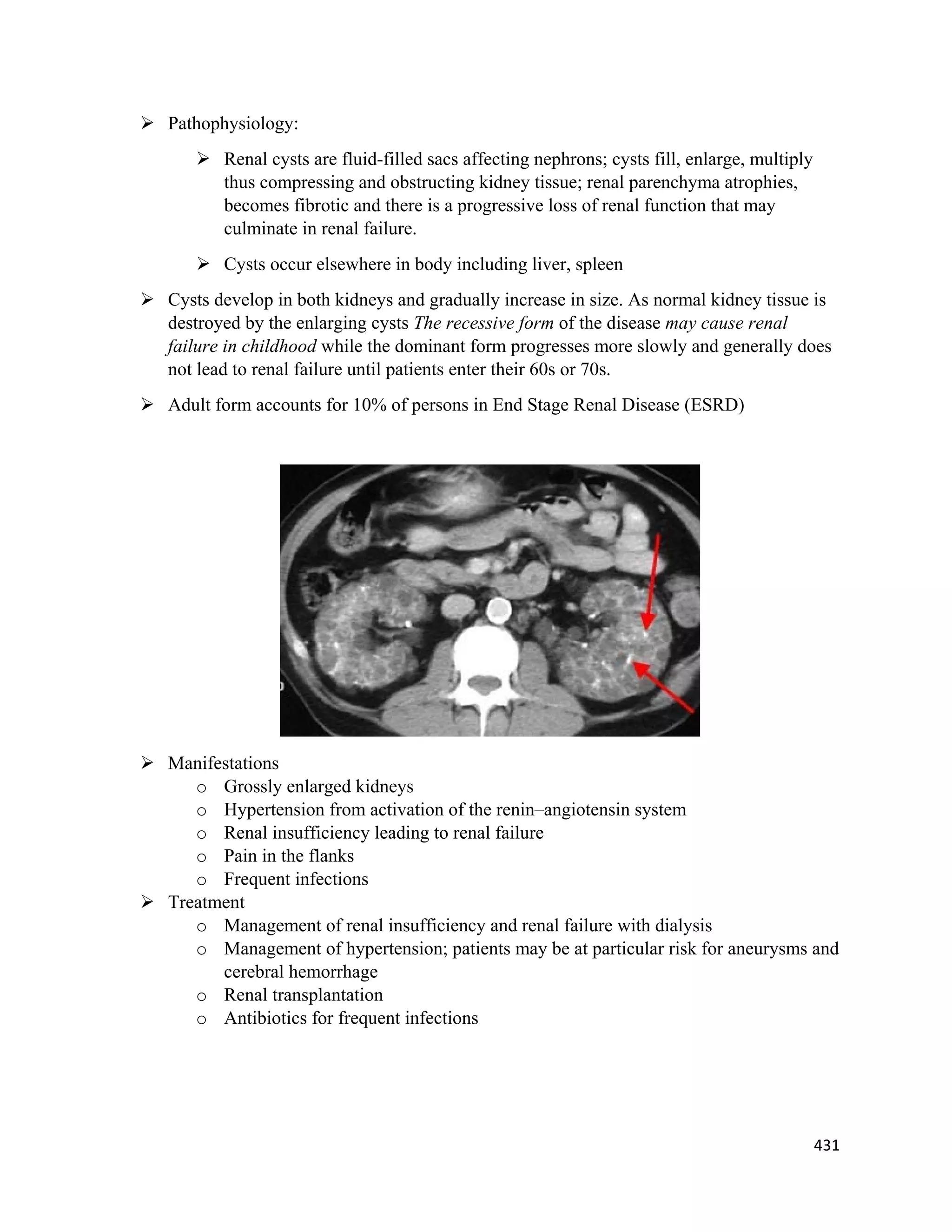 431 
 
 Pathophysiology:
 Renal cysts are fluid-filled sacs affecting nephrons; cysts fill, enlarge, multiply
thus compressing and obstructing kidney tissue; renal parenchyma atrophies,
becomes fibrotic and there is a progressive loss of renal function that may
culminate in renal failure.
 Cysts occur elsewhere in body including liver, spleen
 Cysts develop in both kidneys and gradually increase in size. As normal kidney tissue is
destroyed by the enlarging cysts The recessive form of the disease may cause renal
failure in childhood while the dominant form progresses more slowly and generally does
not lead to renal failure until patients enter their 60s or 70s.
 Adult form accounts for 10% of persons in End Stage Renal Disease (ESRD)
 Manifestations
o Grossly enlarged kidneys
o Hypertension from activation of the renin–angiotensin system
o Renal insufficiency leading to renal failure
o Pain in the flanks
o Frequent infections
 Treatment
o Management of renal insufficiency and renal failure with dialysis
o Management of hypertension; patients may be at particular risk for aneurysms and
cerebral hemorrhage
o Renal transplantation
o Antibiotics for frequent infections
 