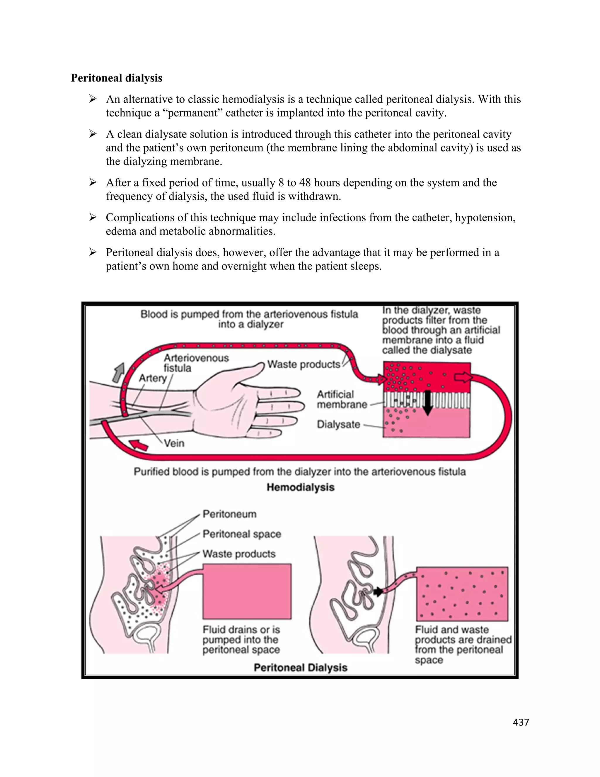 437 
 
Peritoneal dialysis
 An alternative to classic hemodialysis is a technique called peritoneal dialysis. With this
technique a “permanent” catheter is implanted into the peritoneal cavity.
 A clean dialysate solution is introduced through this catheter into the peritoneal cavity
and the patient’s own peritoneum (the membrane lining the abdominal cavity) is used as
the dialyzing membrane.
 After a fixed period of time, usually 8 to 48 hours depending on the system and the
frequency of dialysis, the used fluid is withdrawn.
 Complications of this technique may include infections from the catheter, hypotension,
edema and metabolic abnormalities.
 Peritoneal dialysis does, however, offer the advantage that it may be performed in a
patient’s own home and overnight when the patient sleeps.
 