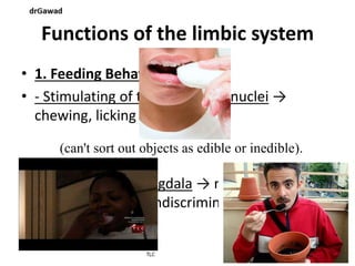 Lecture+15+ppt | PPT