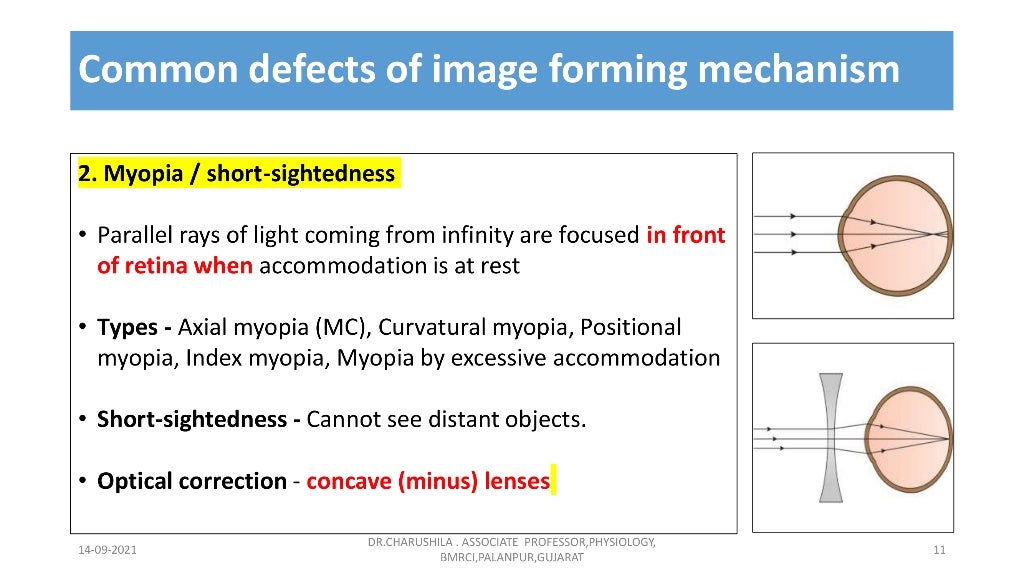 Vision 1 Basics of vision, Optics of the eye , Common…