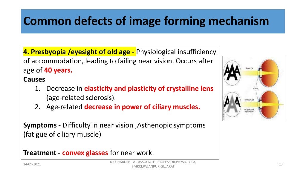 Vision 1 Basics of vision, Optics of the eye , Common…