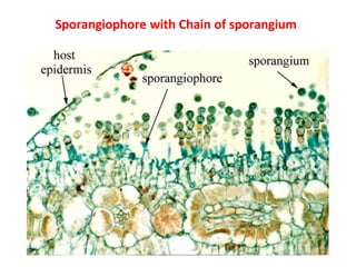 Sporangiophore with Chain of sporangium
 