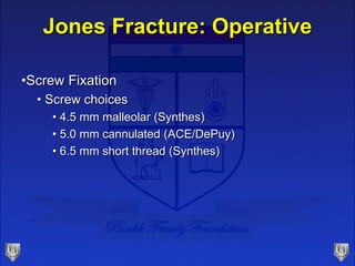 Jones Fracture: Operative
•Screw Fixation
• Screw choices
• 4.5 mm malleolar (Synthes)
• 5.0 mm cannulated (ACE/DePuy)
• 6.5 mm short thread (Synthes)
 