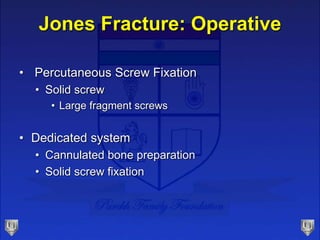 Jones Fracture: Operative
• Percutaneous Screw Fixation
• Solid screw
• Large fragment screws
• Dedicated system
• Cannulated bone preparation
• Solid screw fixation
 