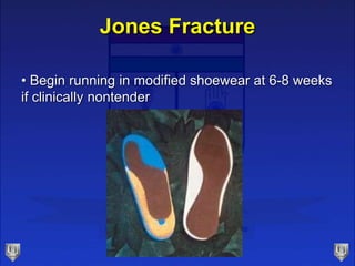 Jones Fracture
• Begin running in modified shoewear at 6-8 weeks
if clinically nontender
 