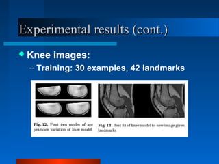 Experimental results (cont.)
 Knee   images:
  – Training: 30 examples, 42 landmarks
 
