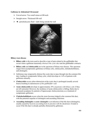 489 
 
Gallstone in Abdominal Ultrasound
 Curved arrow: Two small stones at GB neck
 Straight arrow: Thickened GB wall
 ◄ : pericholecystic fluid = dark lining outside the wall
Biliary tract disease
 Biliary colic is the term used to describe a type of pain related to the gallbladder that
occurs when a gallstone transiently obstructs the cystic duct and the gallbladder contracts.
 Biliary colic and cholecystitis are in the spectrum of biliary tract disease. This spectrum
ranges from asymptomatic gallstones to biliary colic, cholecystitis, choledocholithiasis,
and cholangitis.
 Gallstones may temporarily obstruct the cystic duct or pass through into the common bile
duct, leading to symptomatic biliary colic, which develops in 1-4% of patients with
gallstones annually.
 Cholecystitis occurs when obstruction at the cystic duct is prolonged (usually several
hours) resulting in inflammation of the gallbladder wall.
 Acute cholecystitis develops in approximately 20% of patients with biliary colic if they
are left untreated. However, the incidence of acute cholecystitis is falling, likely due to
increased acceptance by patients of laparoscopic cholecystectomy as a treatment of
symptomatic gallstones.
 Choledocholithiasis occurs when the stone becomes lodged in the common bile duct,
with the potential sequelae of cholangitis and ascending infections.
 Ascending cholangitis or acute cholangitis is an infection of the bile duct (cholangitis),
usually caused by bacteria ascending from its junction with the duodenum. It tends to
occur if the bile duct is already partially obstructed by gallstones.
 