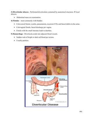 493 
 
3) Diverticular abscess - Perforated diverticulum contained by anatomical structures  local
abscess.
 Abdominal mass on examination.
4) Fistulas – most commonly with bladder.
 Colovesical fistula; cystitis, pneumaturia, recurrent UTIs and faecal debris in the urine.
 Colovaginal fistula; faecal discharge per vagina.
 Fistula with the small intestine leads to diarrhea.
5) Hemorrhage - Diverticula erode into adjacent blood vessels.
 Sudden rush of bright or dark red blood per rectum.
 Usually painless.
 