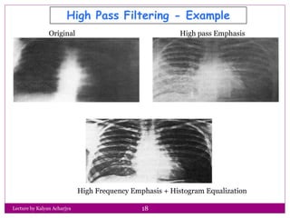 High Pass Filtering - Example
Original High pass Emphasis
High Frequency Emphasis + Histogram Equalization
18Lecture by Ka...