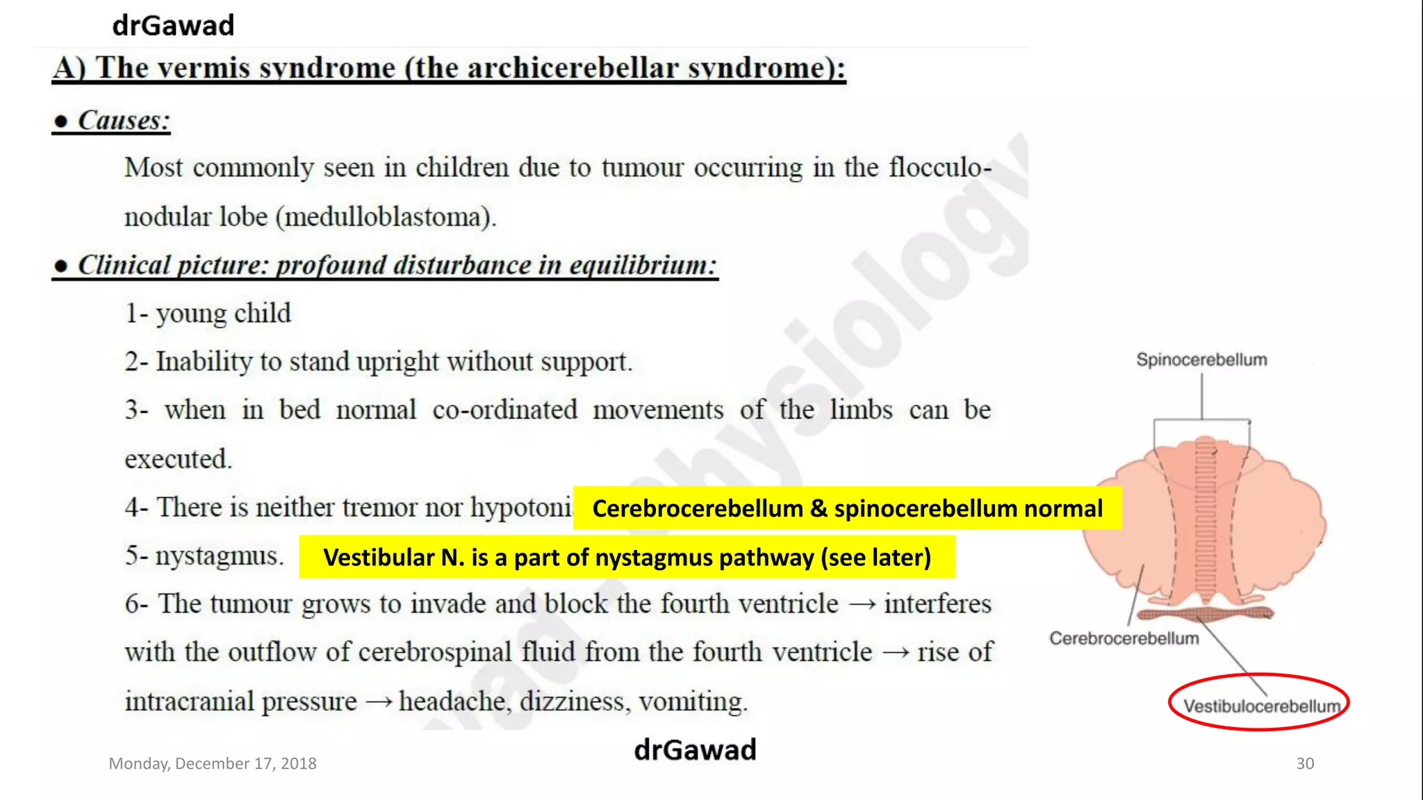 Lecture+17+ppt | PPT