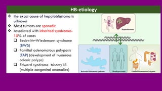 ❖ the exact cause of hepatoblastoma is
unknown
❖ Most tumors are sporadic
❖ Associated with inherited syndromes-
15% of cases
❑ Beckwith–Wiedemann syndrome
(BWS)
❑ Familial adenomatous polyposis
(FAP) (development of numerous
colonic polyps)
❑ Edward syndrome trisomy18
(multiple congenital anomalies)
HB-etiology
 