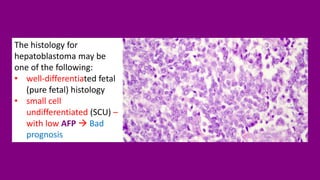The histology for
hepatoblastoma may be
one of the following:
• well-differentiated fetal
(pure fetal) histology
• small cell
undifferentiated (SCU) –
with low AFP → Bad
prognosis
 
