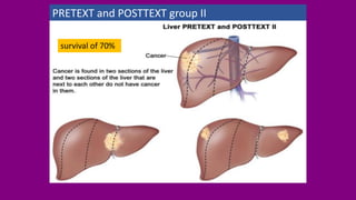PRETEXT and POSTTEXT group II
survival of 70%
 