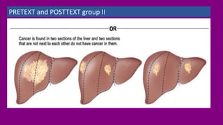 PRETEXT and POSTTEXT group II
 