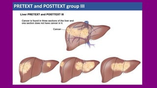 PRETEXT and POSTTEXT group III
 