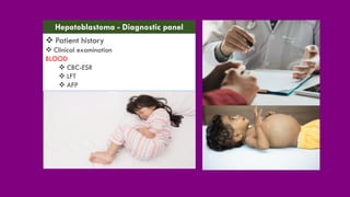 ❖ Patient history
❖ Clinical examination
BLOOD
❖ CBC-ESR
❖ LFT
❖ AFP
Hepatoblastoma - Diagnostic panel
 