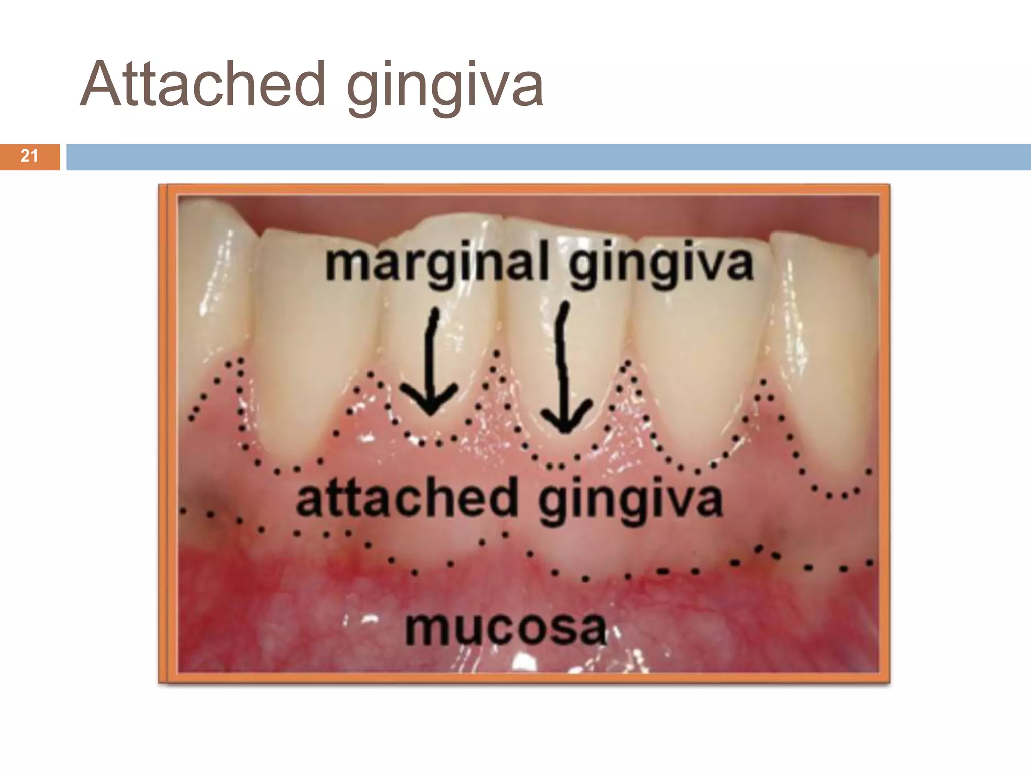 Attached gingiva
21
 