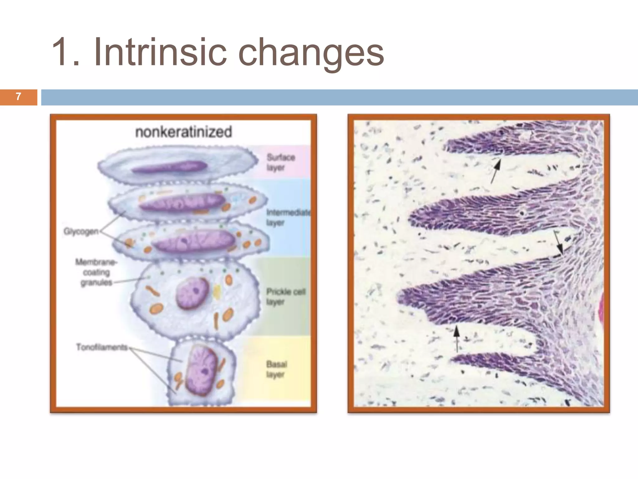 1. Intrinsic changes
7
 